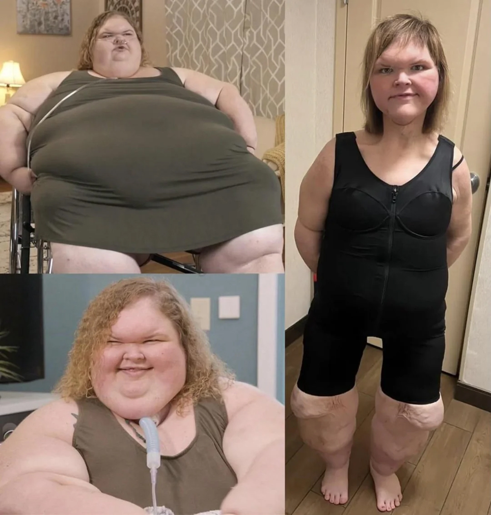 Tammy Slaton Weight Loss Story