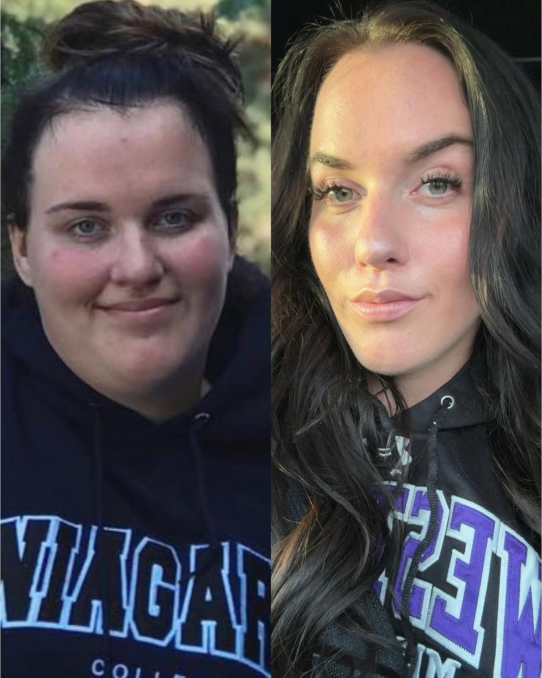 Emma Hooker Weight Loss 